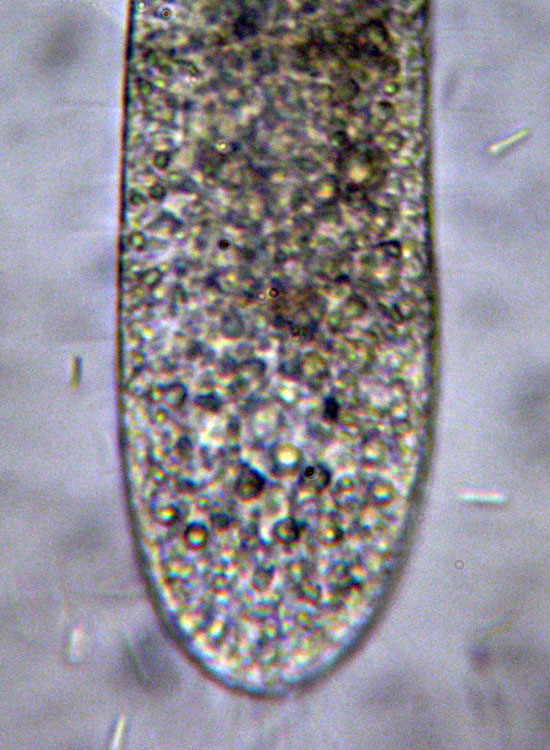 Protozoi marini: Trachelostyla pediculiformis ?